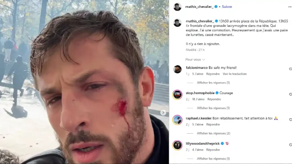 Mathis Chevalier : le combattant de MMA témoigne après sa blessure à l’œil